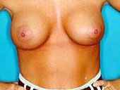 Patient # 47598 After Photo # 2